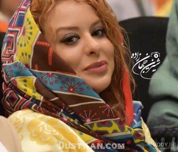 زهرا اویسی قبل از عمل زیبایی