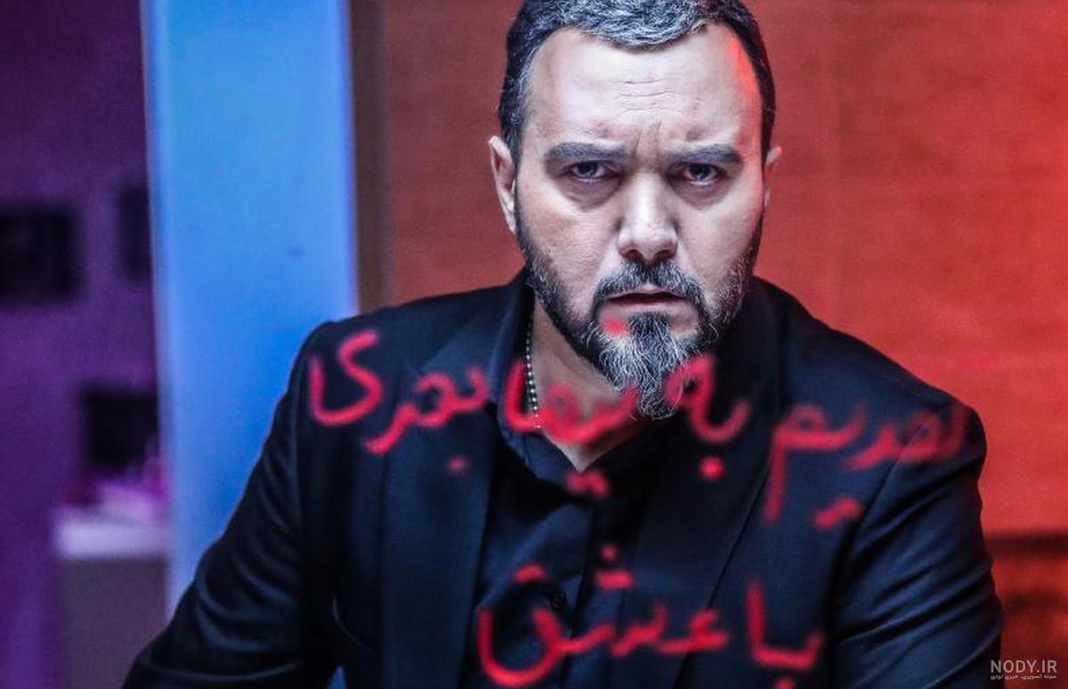 سامیه لک قبل از عمل سامیه لک قبل از عمل