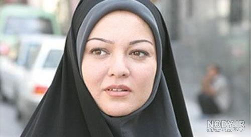 علت تغییر چهره رزیتا غفاری علت تغییر چهره رزیتا غفاری