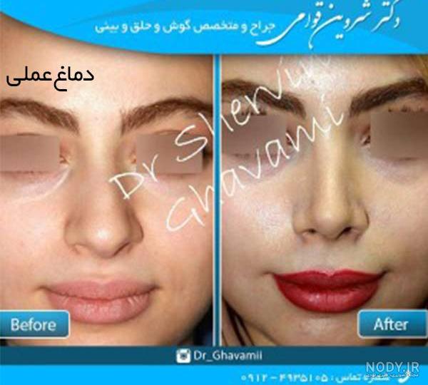 عکس بینی فانتزی عکس بینی فانتزی