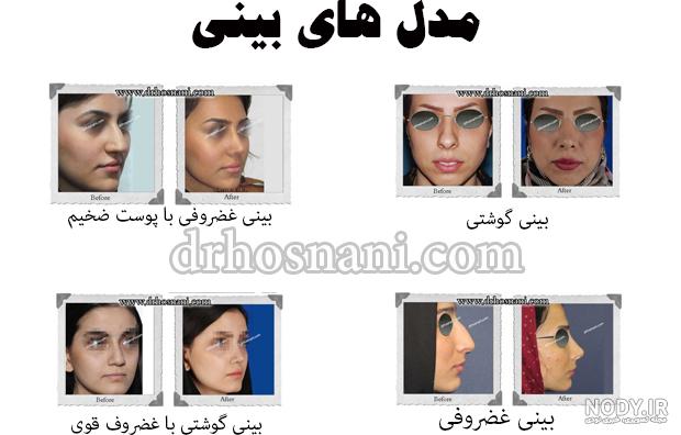 عکس دختر دماغ عملی خوشگل عکس دختر دماغ عملی خوشگل