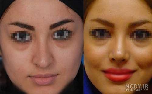 عکس دماغ عملی با چسب عکس دماغ عملی با چسب