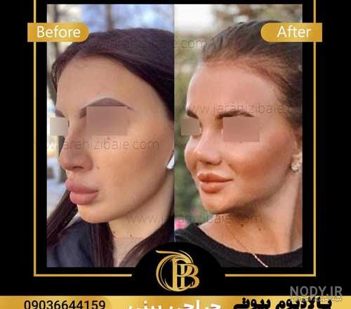 عکس دماغ عملی عروسکی عکس دماغ عملی عروسکی