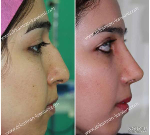 عکس دماغ عملی گوشتی عکس دماغ عملی گوشتی