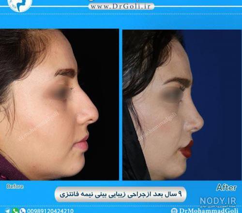 عکس دماغ عملی گوشتی عکس دماغ عملی گوشتی