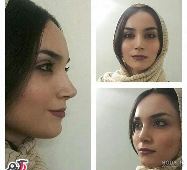 عکس زیباترین بینی های عمل شده در ایران عکس زیباترین بینی های عمل شده در ایران