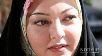 عکس قبل و بعد رزیتا غفاری عکس قبل و بعد رزیتا غفاری