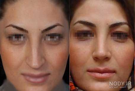 عکس مدل های بینی عملی عکس مدل های بینی عملی