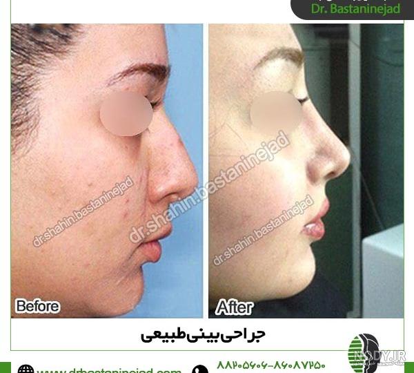 عکس پسر دماغ عملی خوشگل عکس پسر دماغ عملی خوشگل
