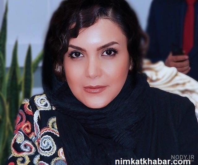 عکس ژاله صامتی قبل از عمل بینی عکس ژاله صامتی قبل از عمل بینی