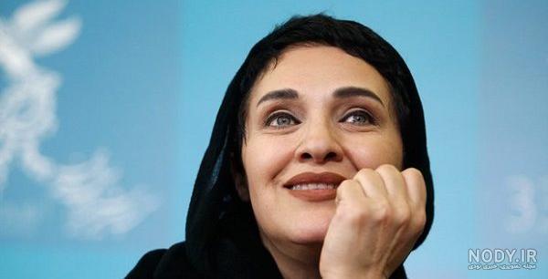 بازیگران کچل ایرانی مرد