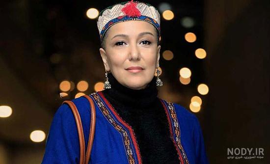 بازیگران کچل خارجی معروف