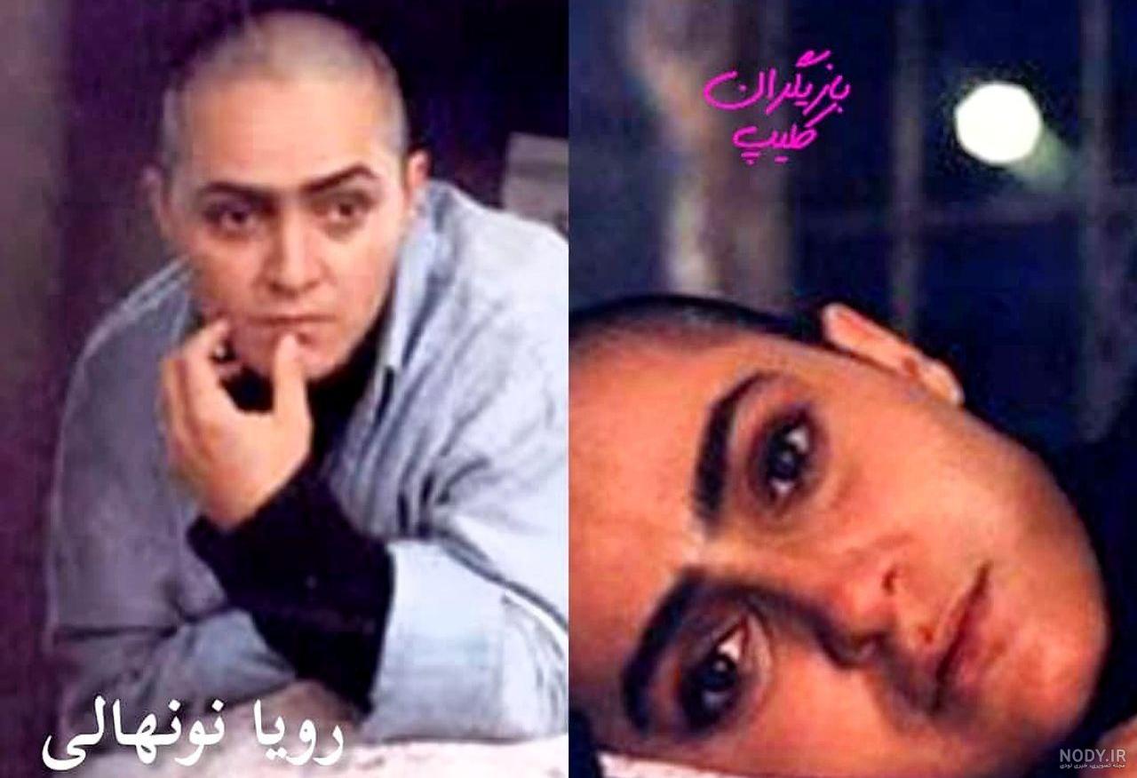 زن کچل خواننده