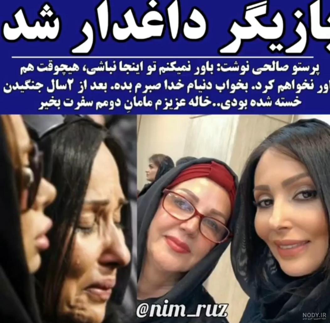 عکس بازیگران ترکیه قبل و بعد از عمل زیبایی