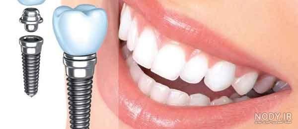 عکس دختر شاد فانتزی عکس دختر شاد فانتزی
