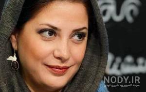 عکس طناز طباطبایی قبل از عمل