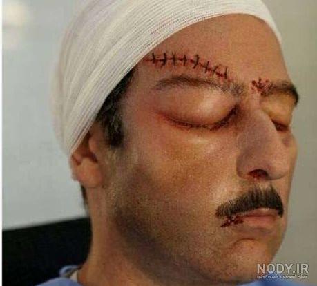 عکس فرهاد بشارتی