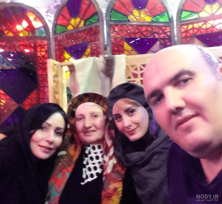 عکس قبل و بعد عمل زیبایی بازیگران ایرانی
