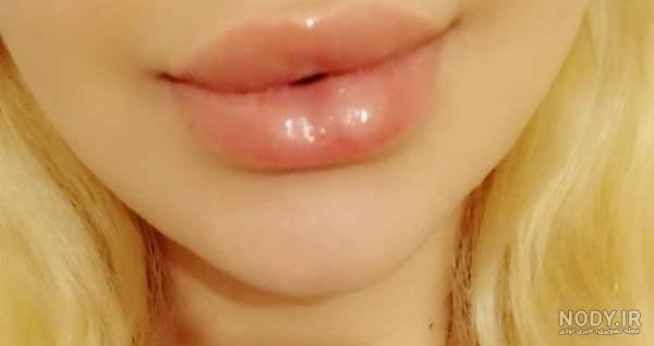 عکس پروتز لب سحر قریشی