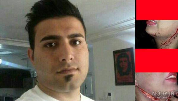 عکس چاقو خوردگی