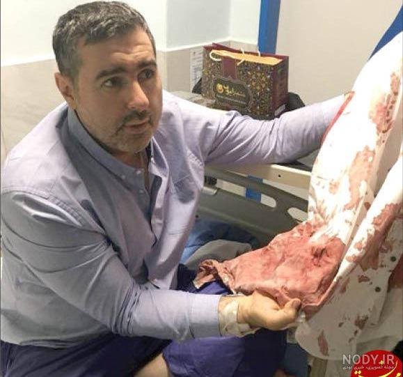عکس چاقو خوردگی شکم