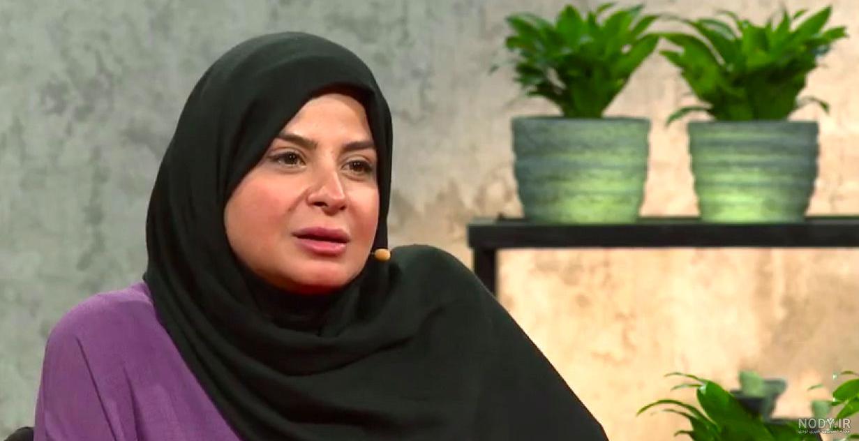 نیکی کریمی قبل از عمل بینی نیکی کریمی قبل از عمل بینی
