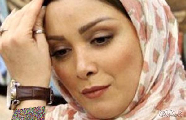 آیا بهاره رهنما بینی عمل کرده آیا بهاره رهنما بینی عمل کرده