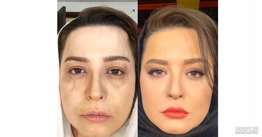 بازیگر سریال دل