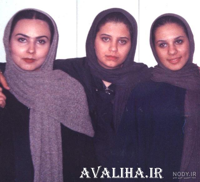 بدشانس عمل زیبایی ناموفق بازیگران ایرانی
