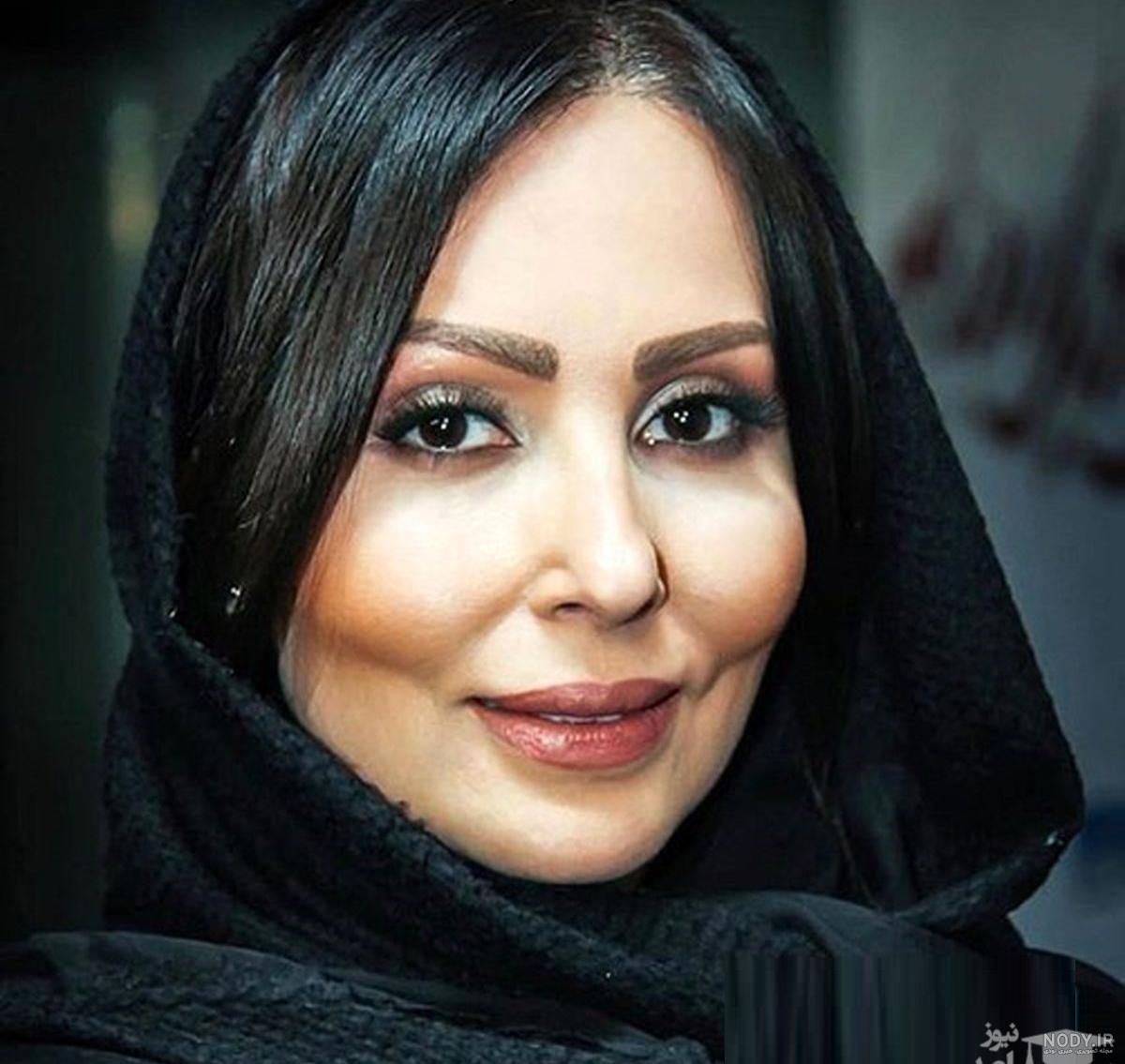 حدیث فولادوند بعد از عمل حدیث فولادوند بعد از عمل