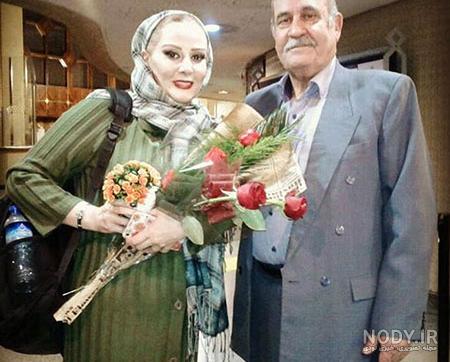 شیوا خسرو مهر بعد از تزریق ژل