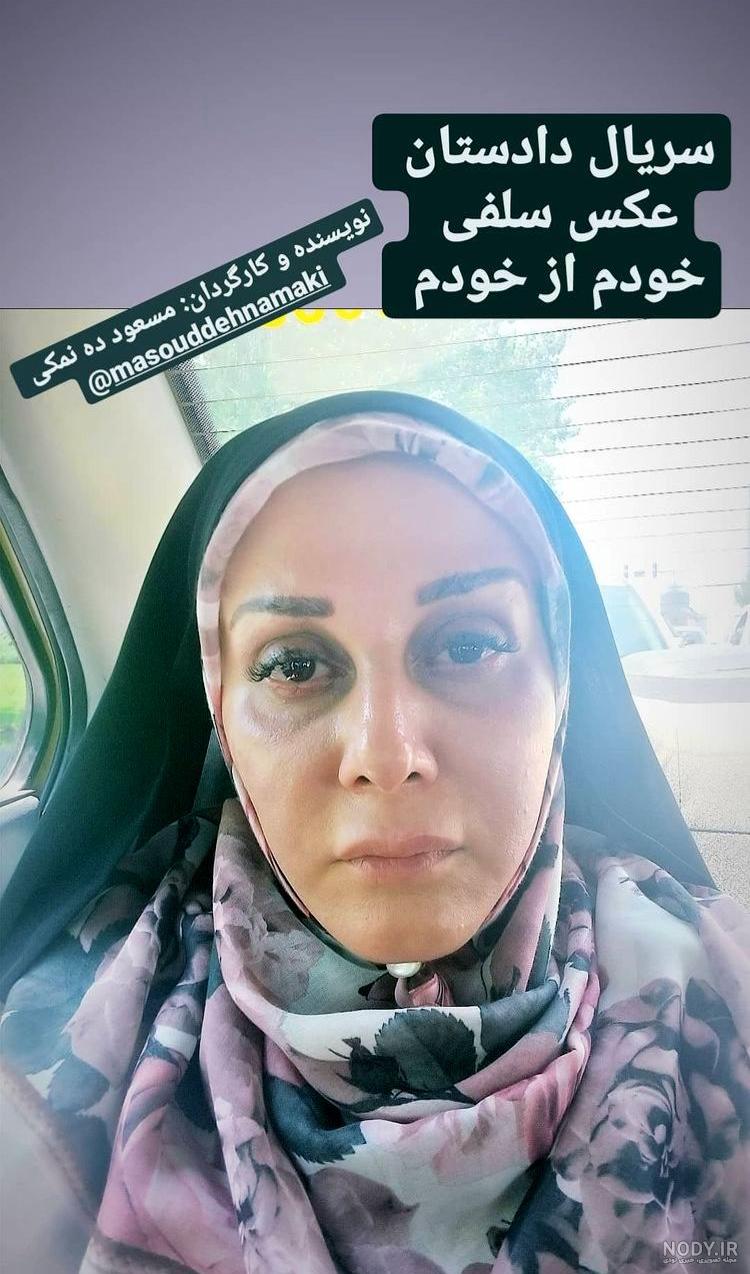 شیوا خسرومهر در دوپینگ