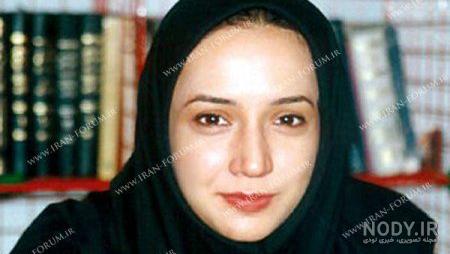 عاطفه رضوی قبل از عمل بینی