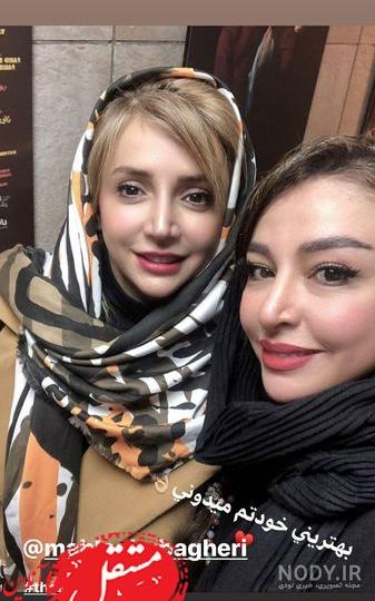 عکس دخترانی که عمل زیبایی کرده اند