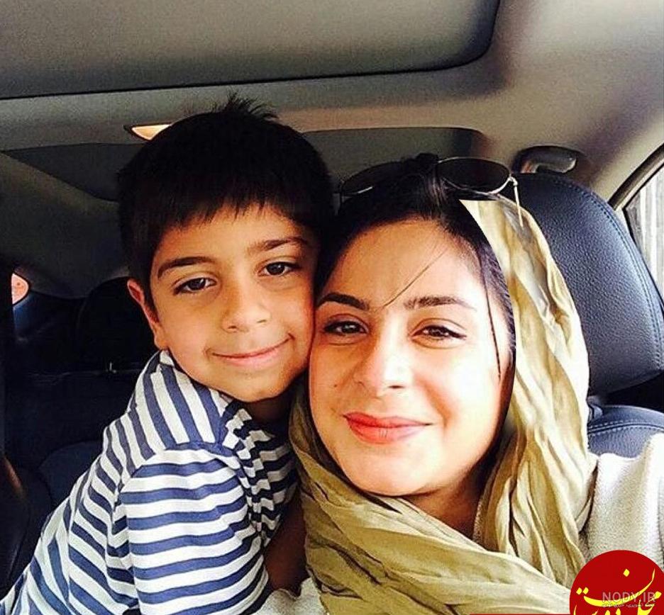 عکس سیما تیرانداز قبل از عمل بینی عکس سیما تیرانداز قبل از عمل بینی