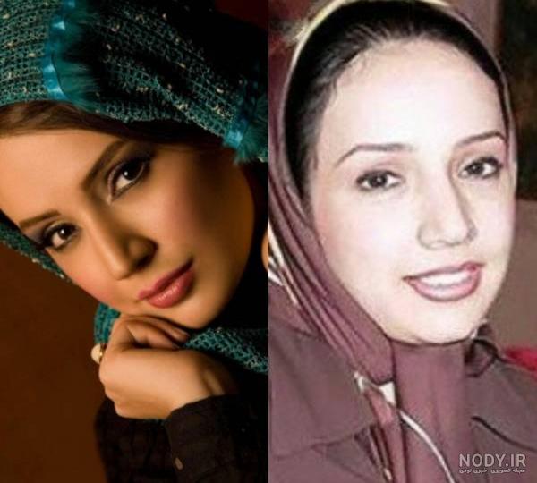 عکس شبنم قلی خانی قبل از عمل زیبایی