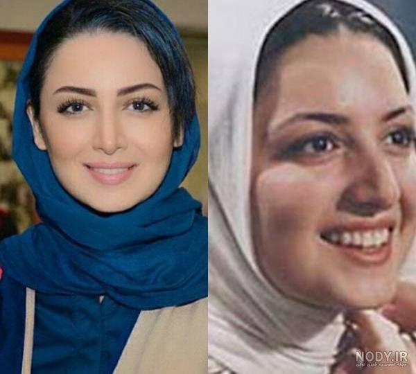 عکس عمل زیبایی