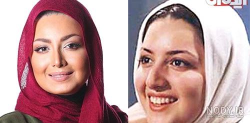 عکس عمل های زیبایی وحشتناک