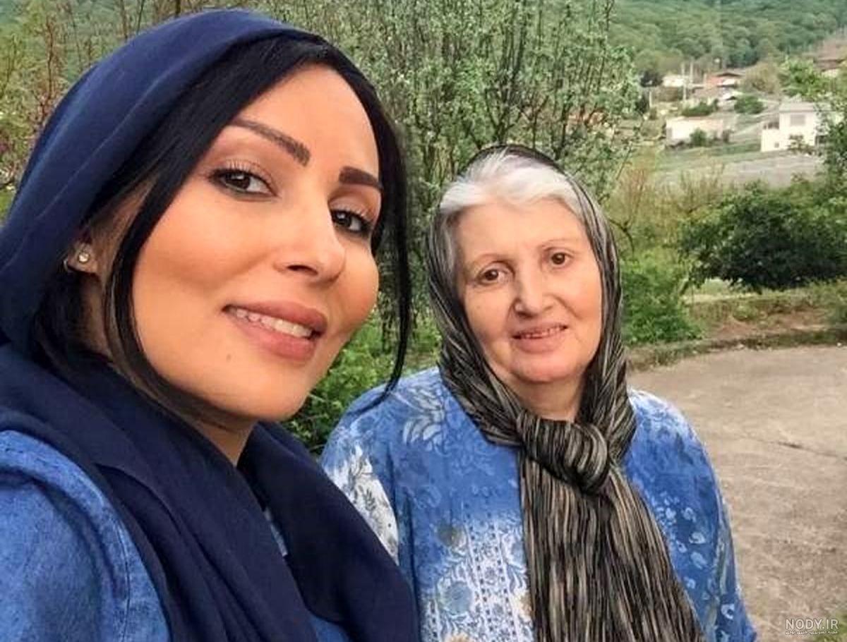 عکس لیندا کیانی قبل از عمل زیبایی عکس لیندا کیانی قبل از عمل زیبایی