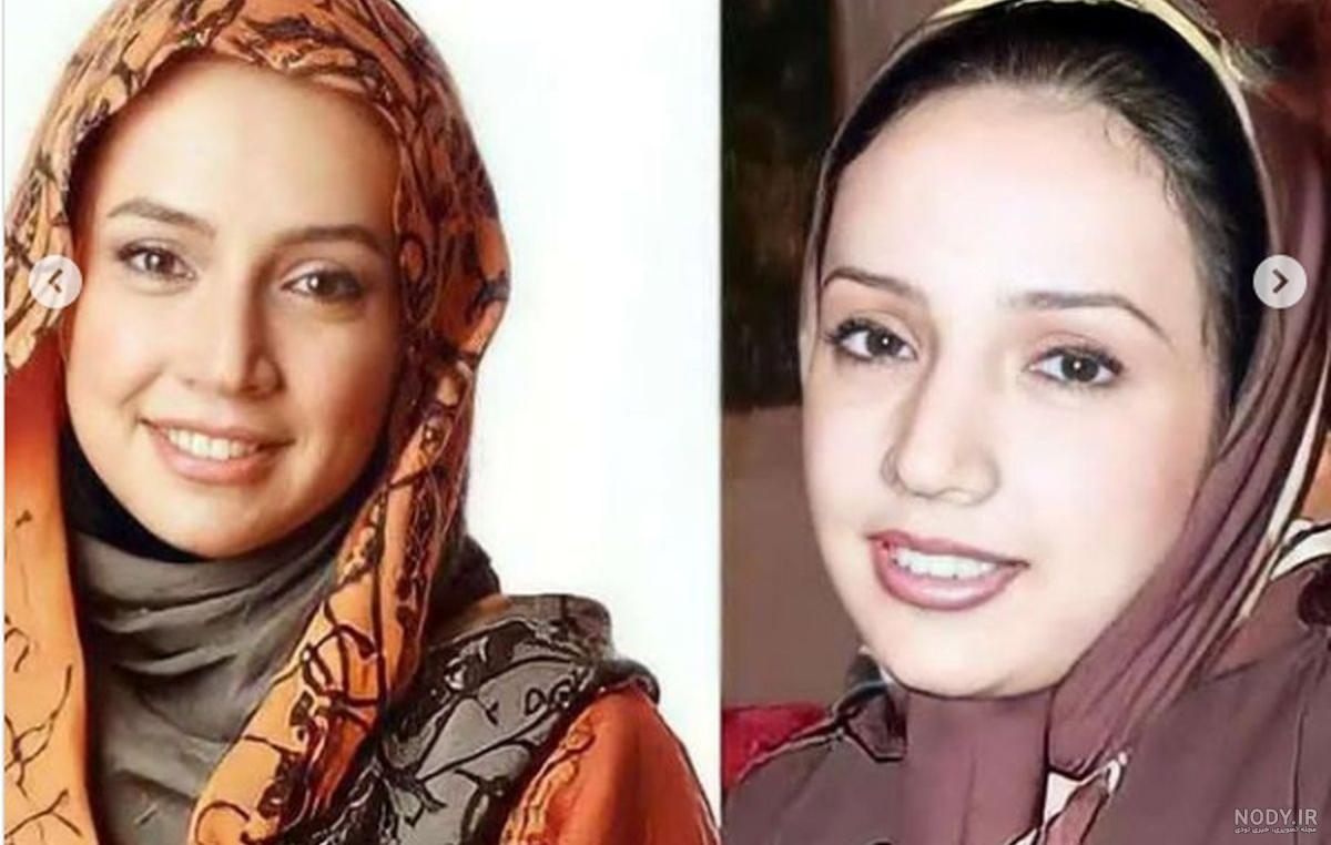 عکس های شبنم قلی خانی قبل از عمل زیبایی عکس های شبنم قلی خانی قبل از عمل زیبایی