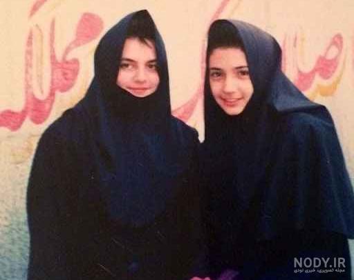 عکس های قبل از عمل شبنم قلی خانی