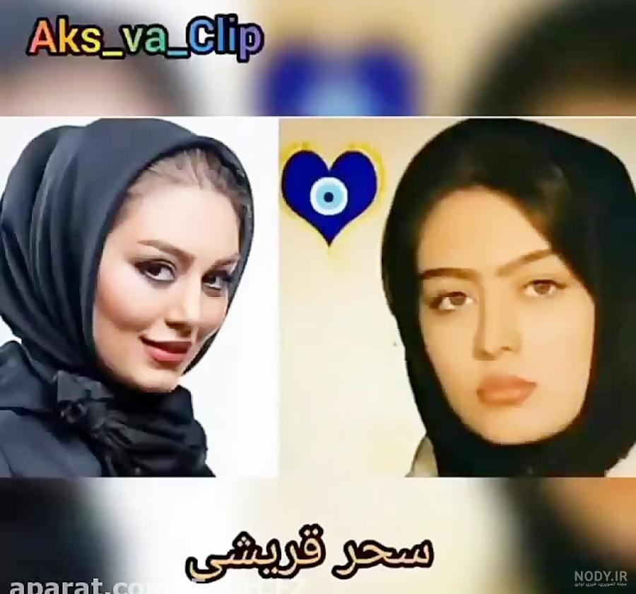 قبل و بعد عمل زیبایی