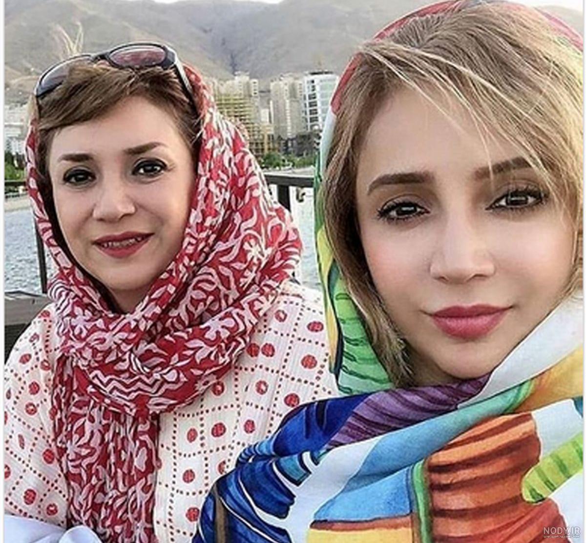 محمدرضا گلزار قبل از کاشت مو
