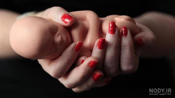 عکس جنین سقط شده سه ماهه دختر