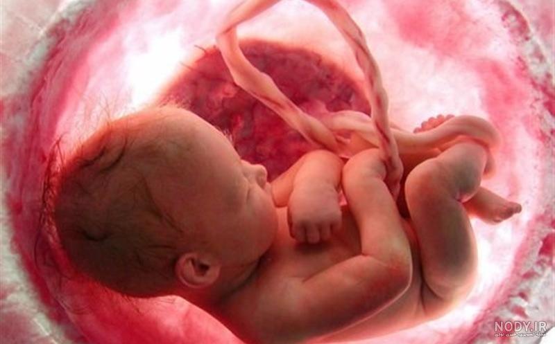 عکس جنین سقط شده پسر دو ماهه