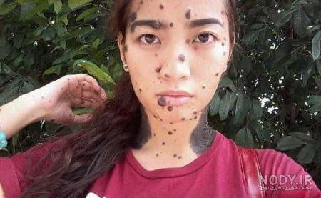 عکس صورت خال خالی