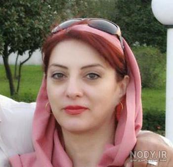 فقیهه سلطانی بعد از عمل زیبایی فقیهه سلطانی بعد از عمل زیبایی