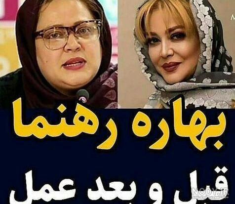تصاویر بهاره رهنما بعد از عمل لاغری