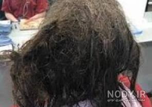 شپش از چی بدش میاد