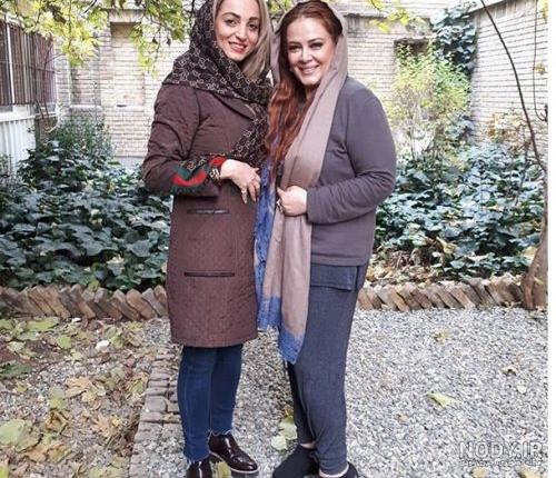 عکس بهاره رهنما بعد عمل